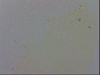 Doryphoribius evelinae image