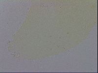 Doryphoribius evelinae image