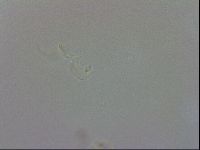 Doryphoribius evelinae image