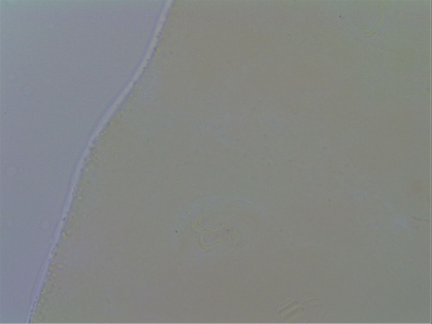 Macrobiotus echinogenitus image