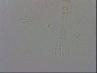 Mesobiotus coronatus image