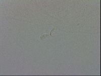 Mesobiotus coronatus image