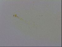 Mesobiotus coronatus image