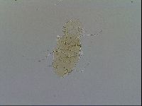 Echiniscus testudo image