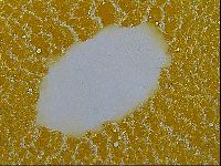 Echiniscus testudo image