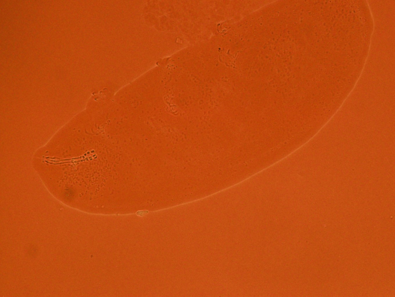 Doryphoribius zyxiglobus image
