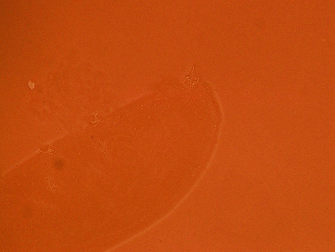 Doryphoribius zyxiglobus image