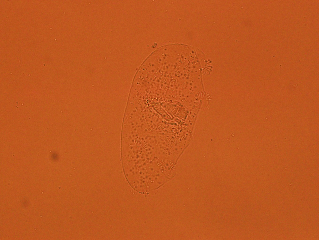 Echiniscoides sigismundi image