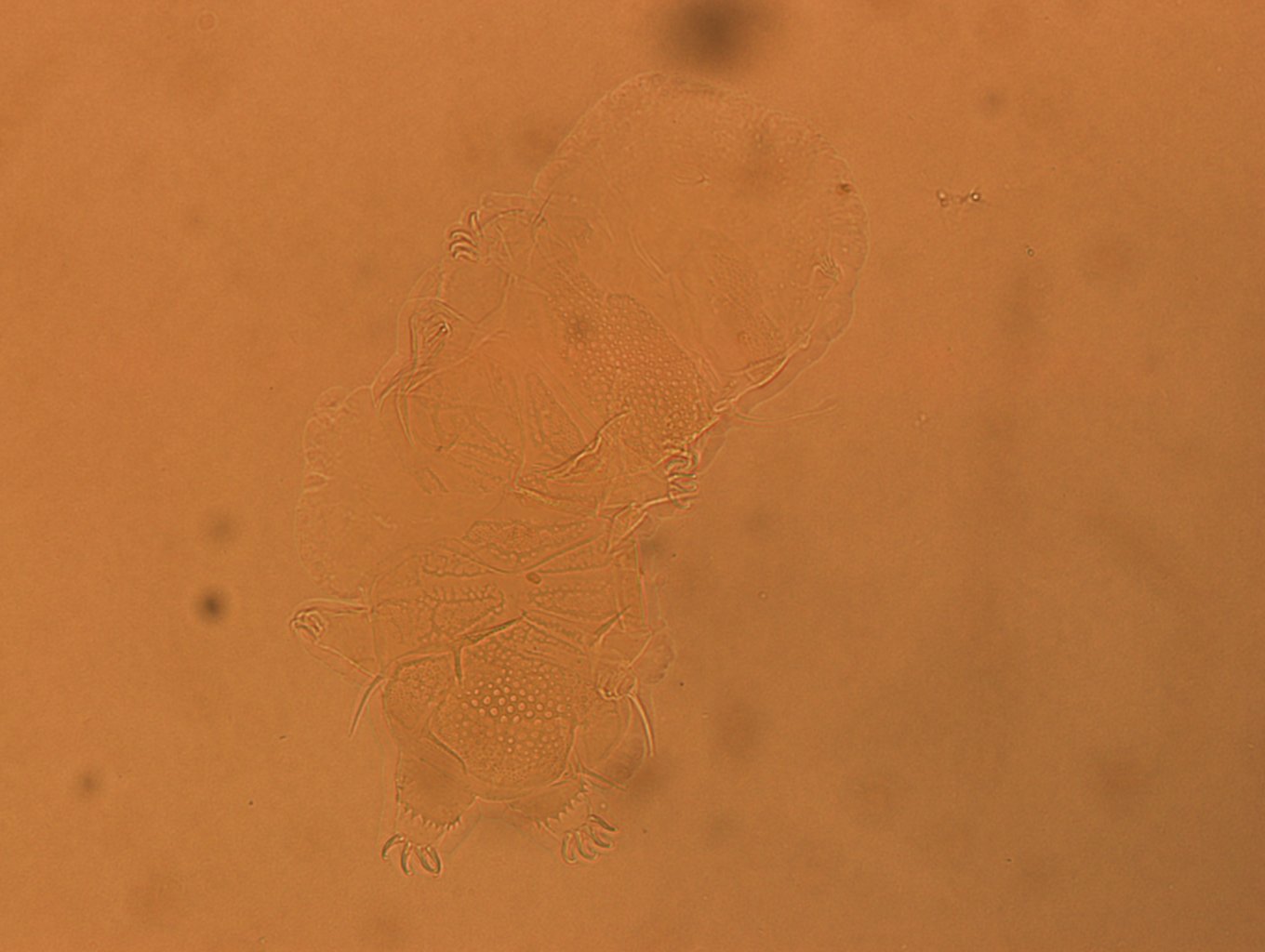 Echiniscus africanus image