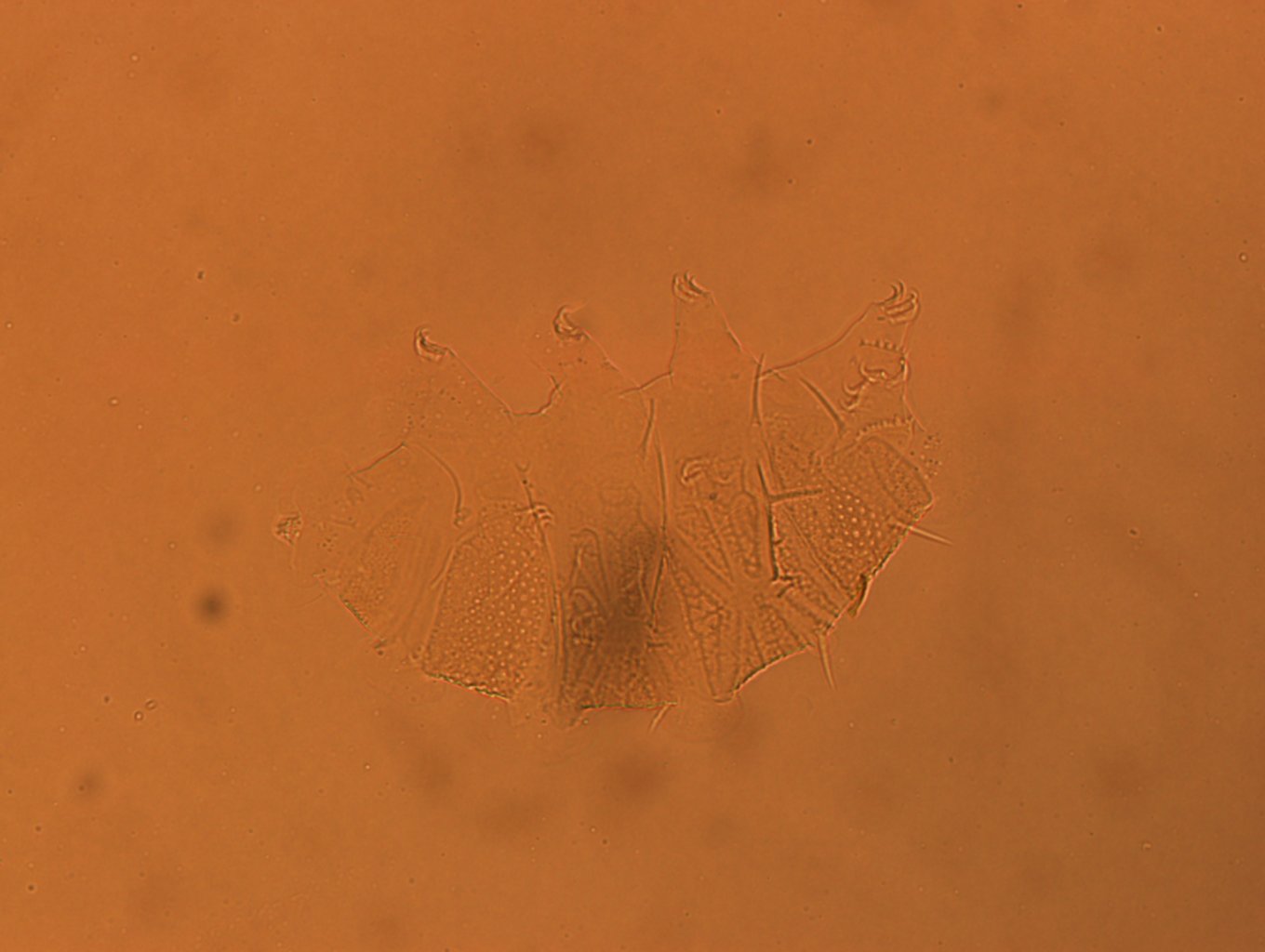 Echiniscus africanus image