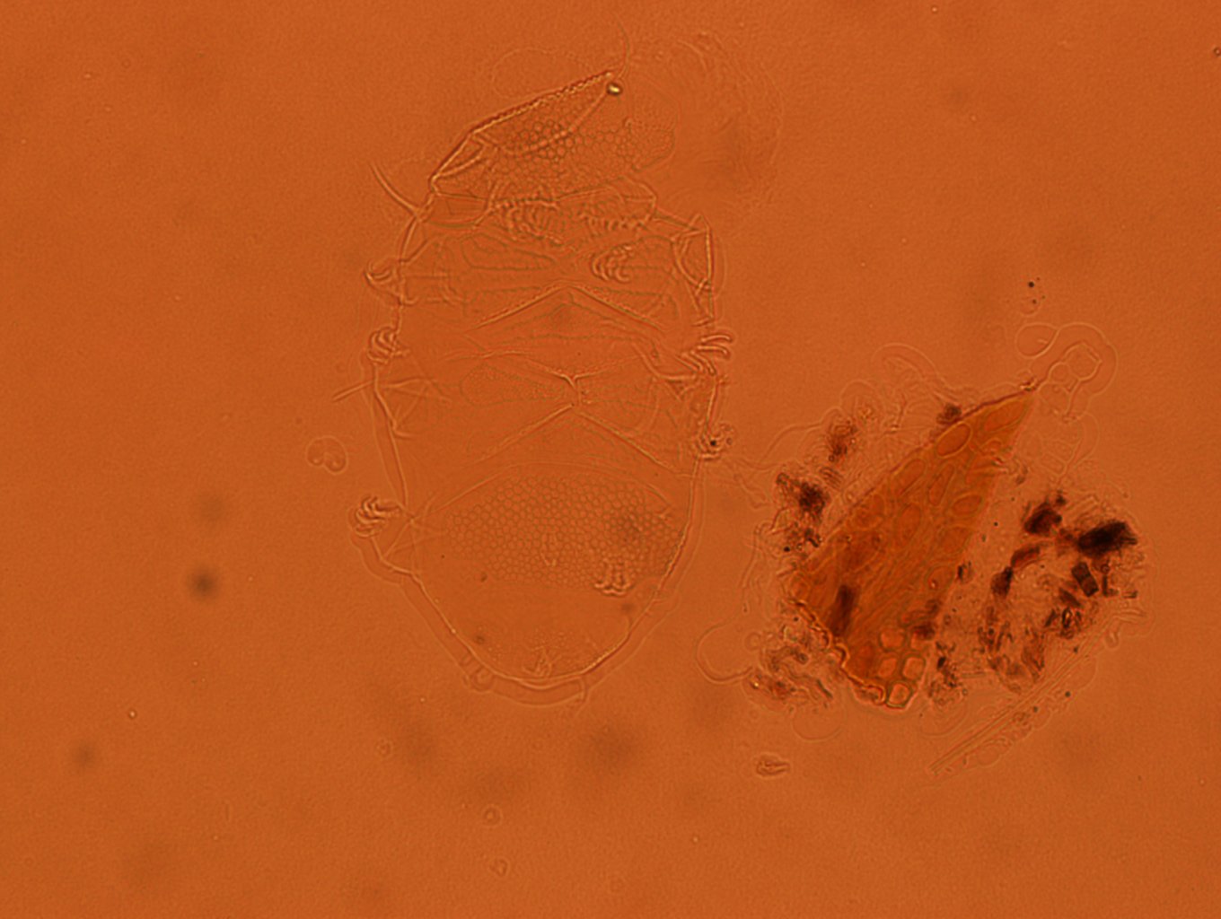 Echiniscus africanus image