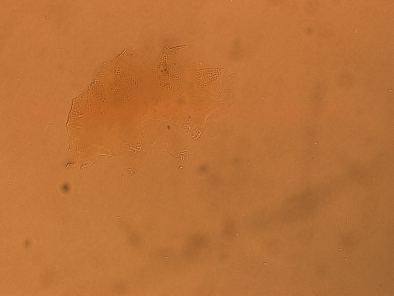 Echiniscus angolensis image