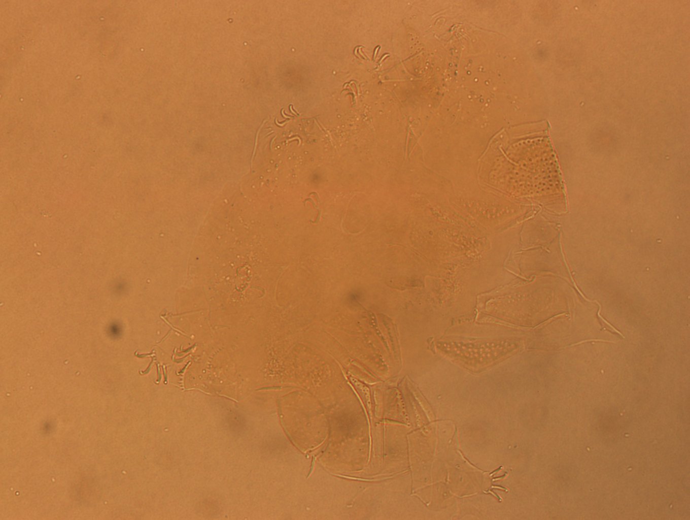 Echiniscus angolensis image