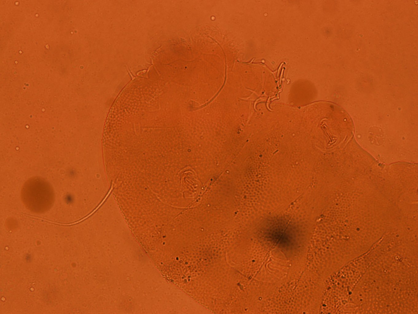 Echiniscus kerguelensis image