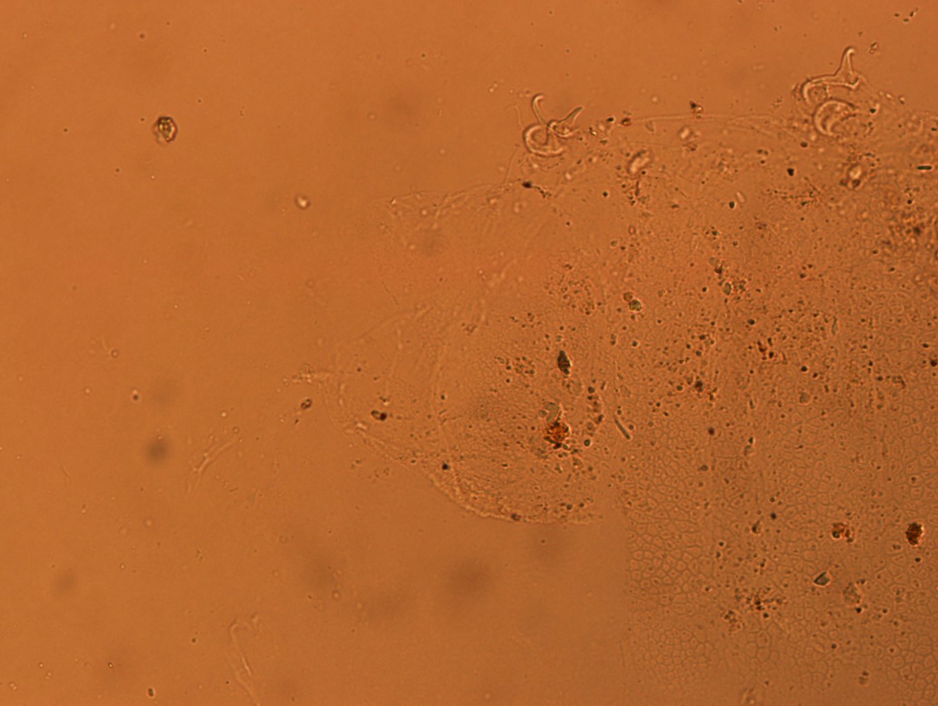 Doryphoribius flavus image