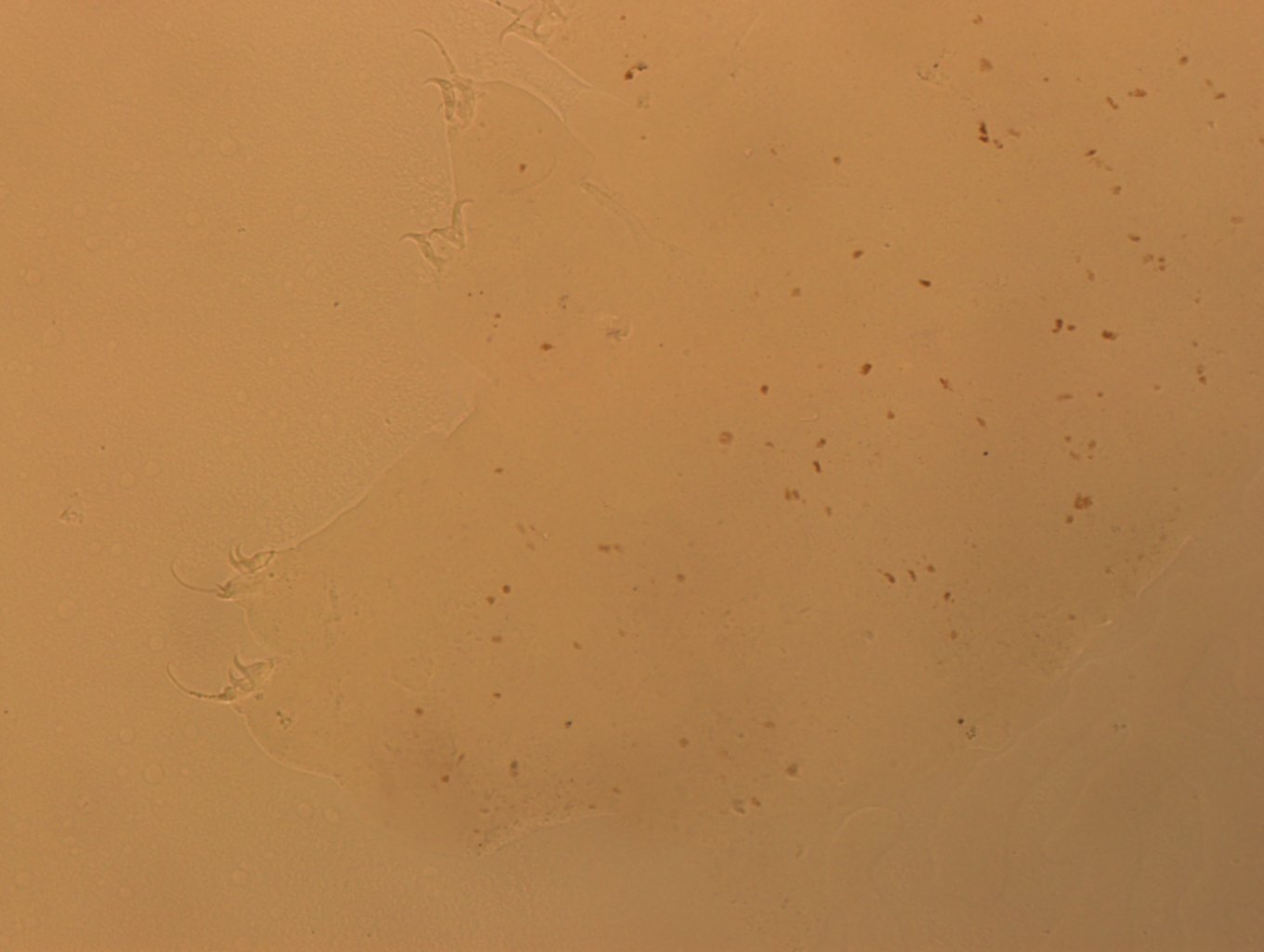 Hypsibius calcaratus image