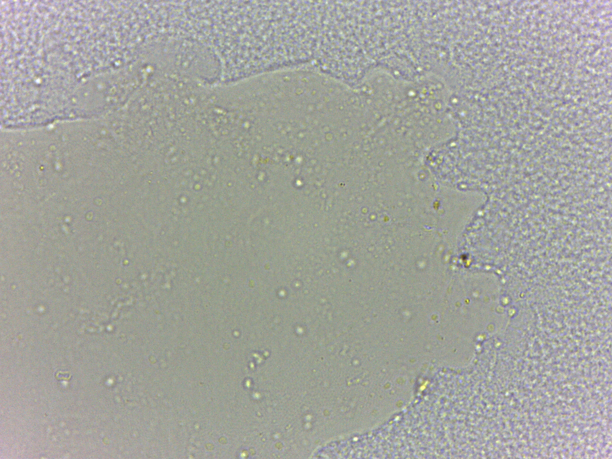 Batillipedidae image