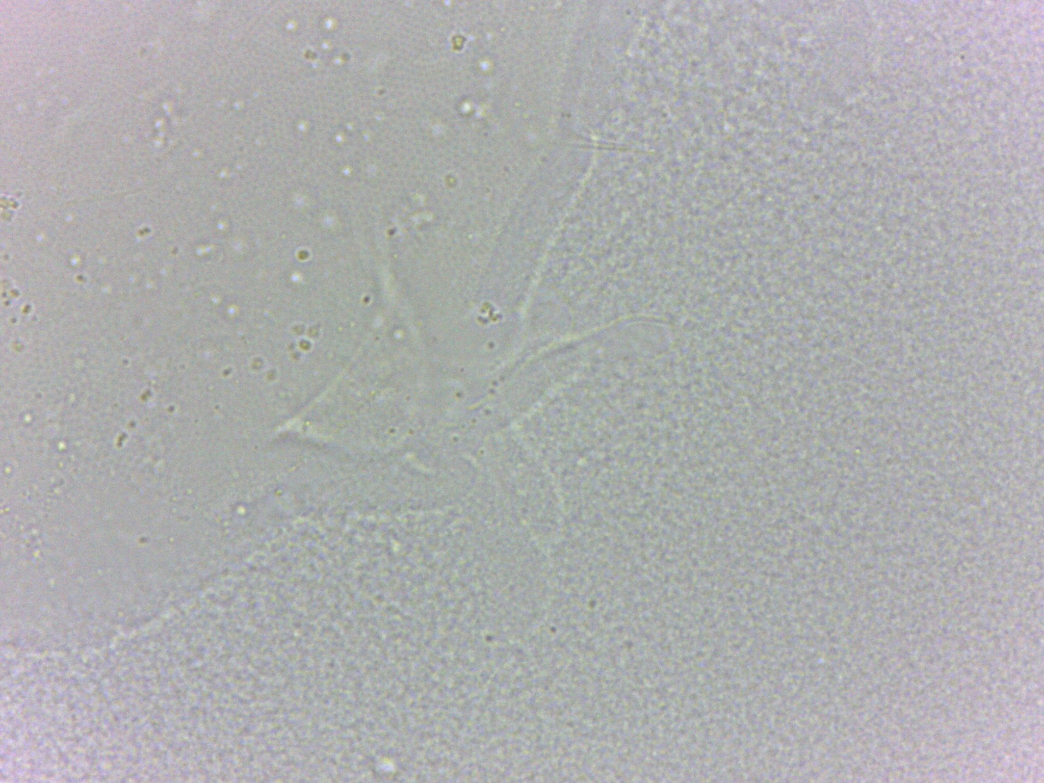Batillipes minius image