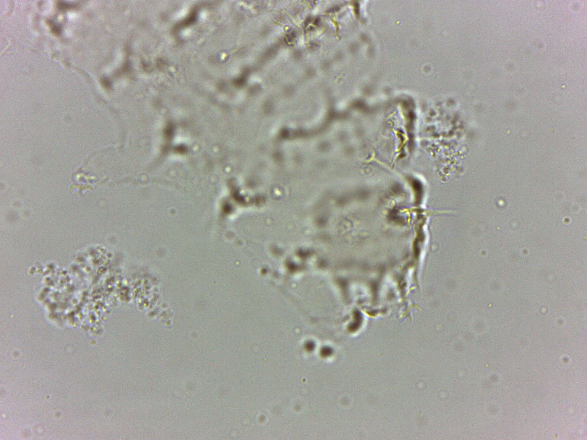 Calohypsibiidae image