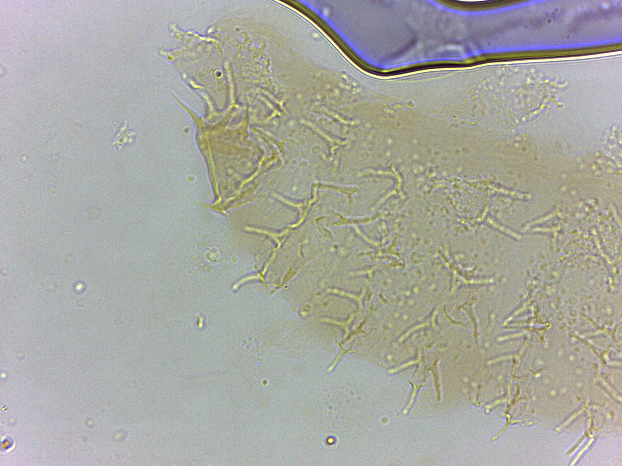 Calohypsibiidae image