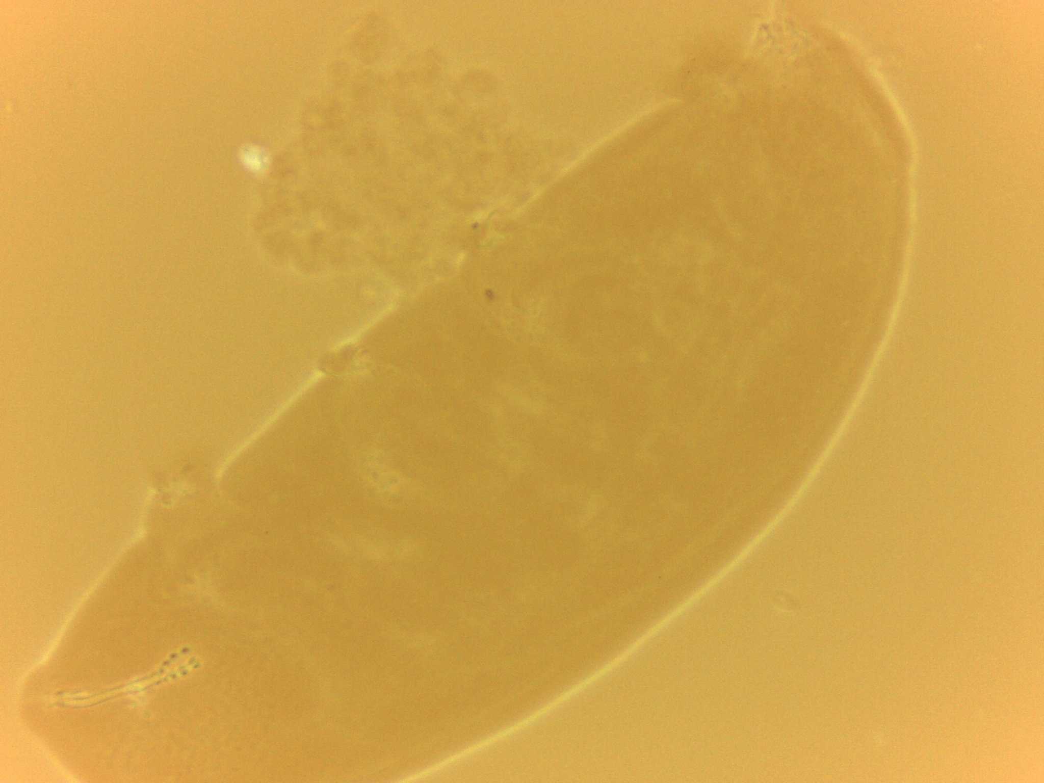 Doryphoribius zyxiglobus image