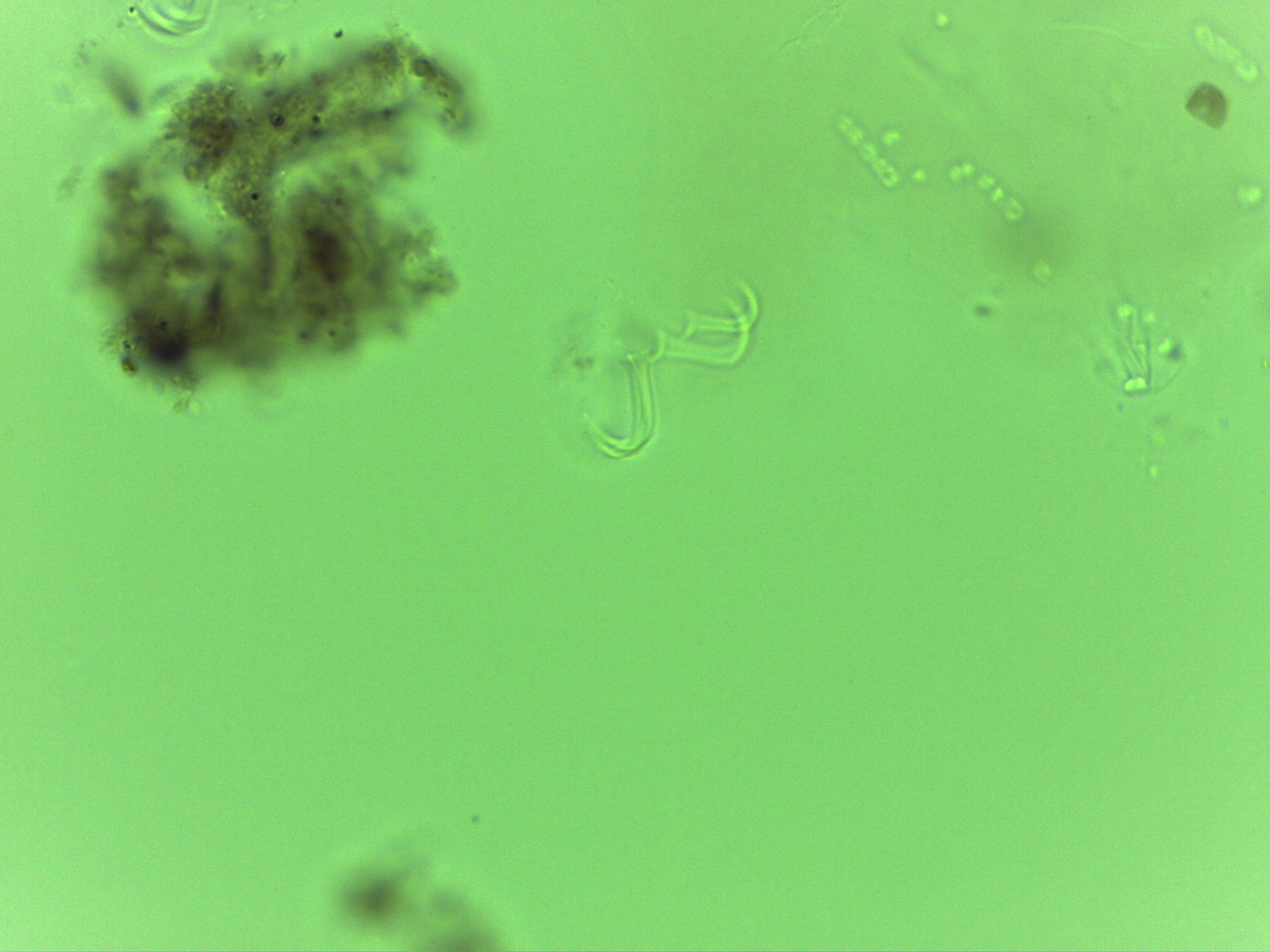Echiniscoides sigismundi image