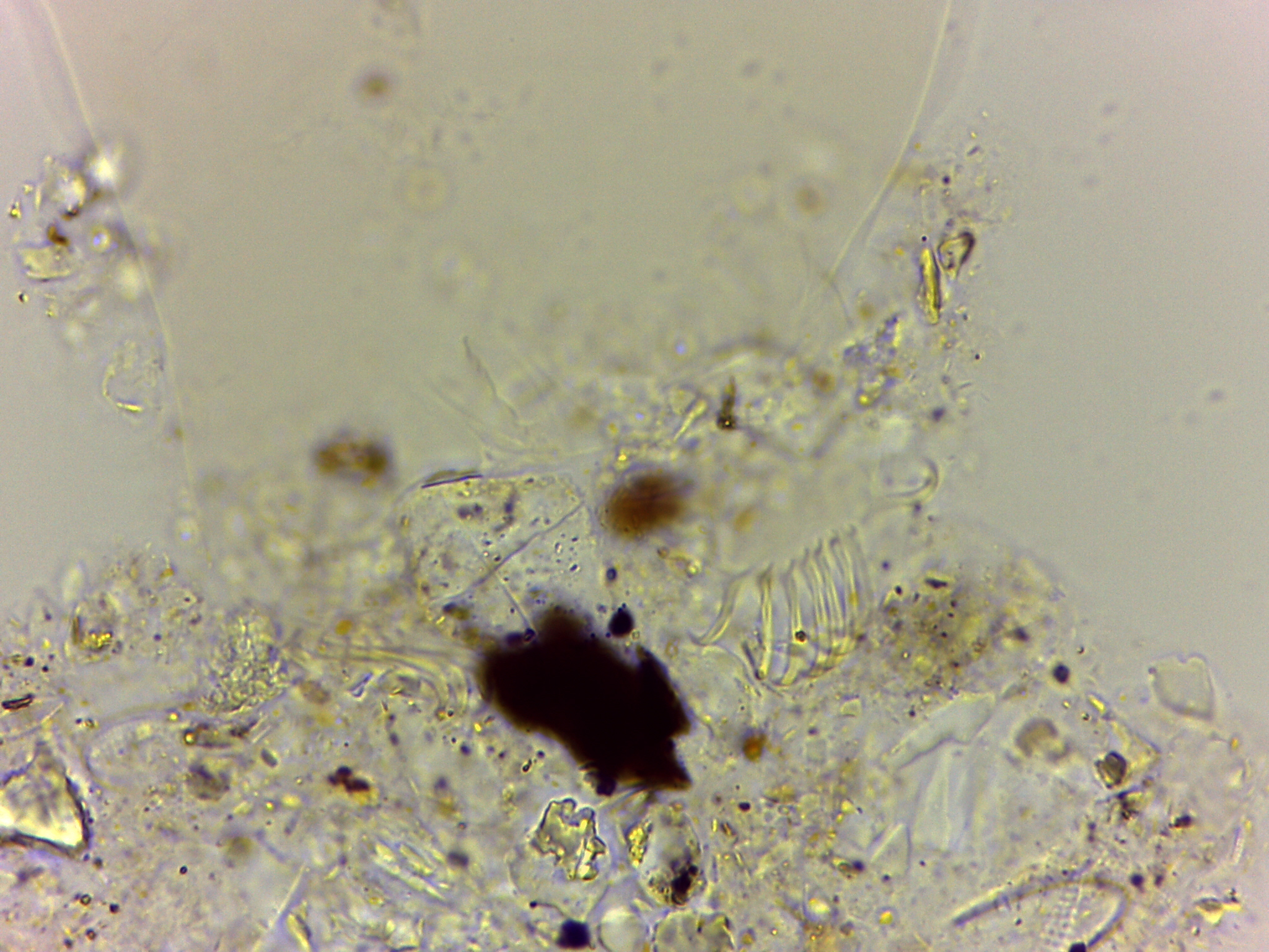 Echiniscoides sigismundi image