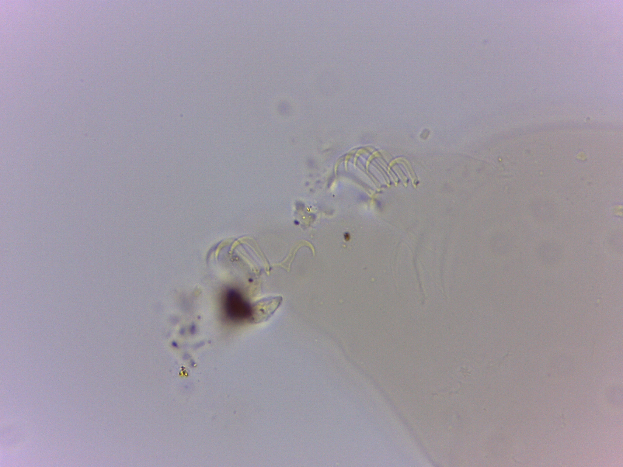 Echiniscoides sigismundi image