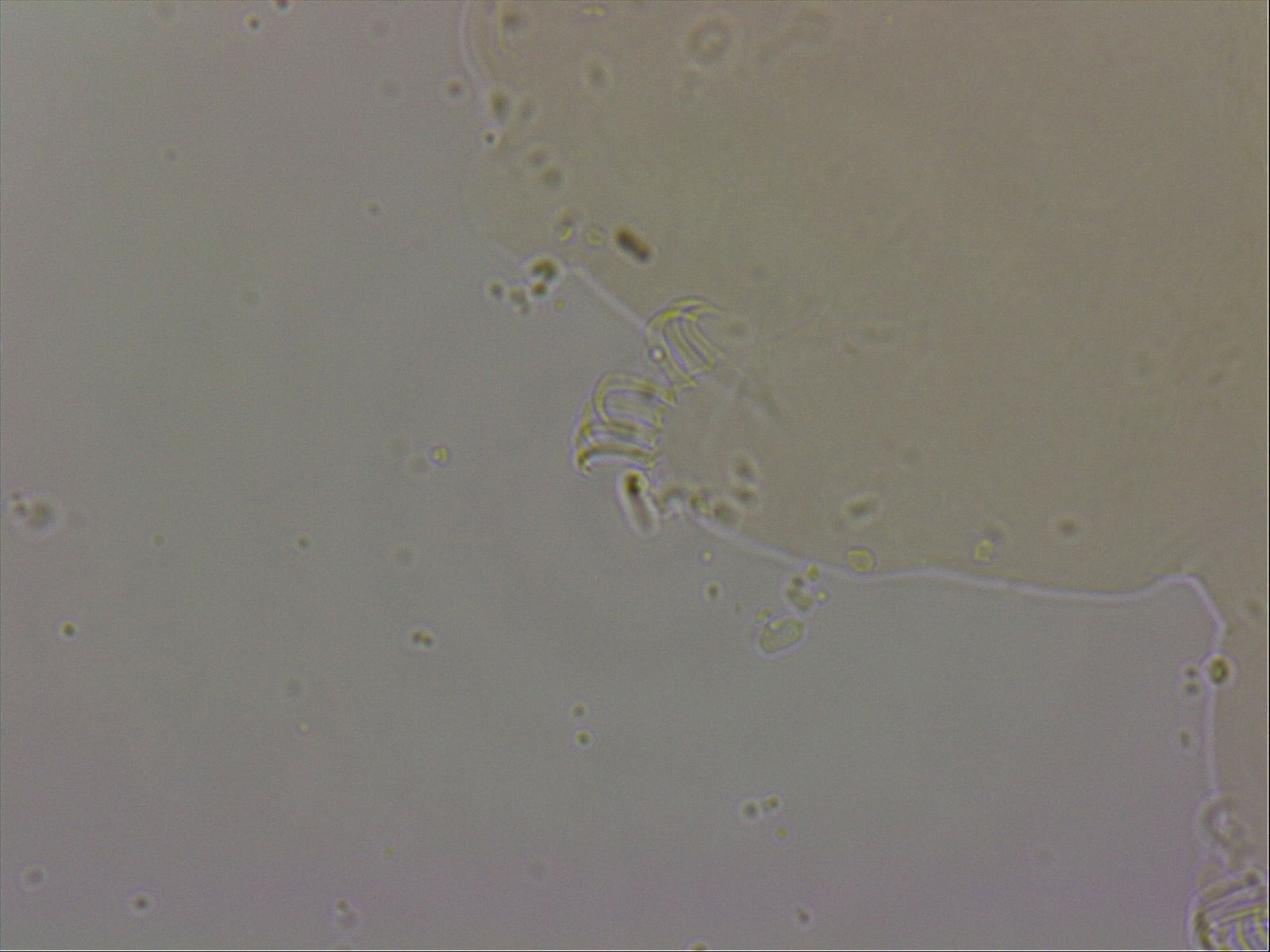 Echiniscoides sigismundi image