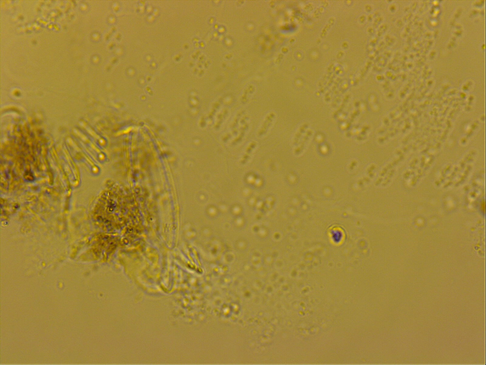 Echiniscoides sigismundi image