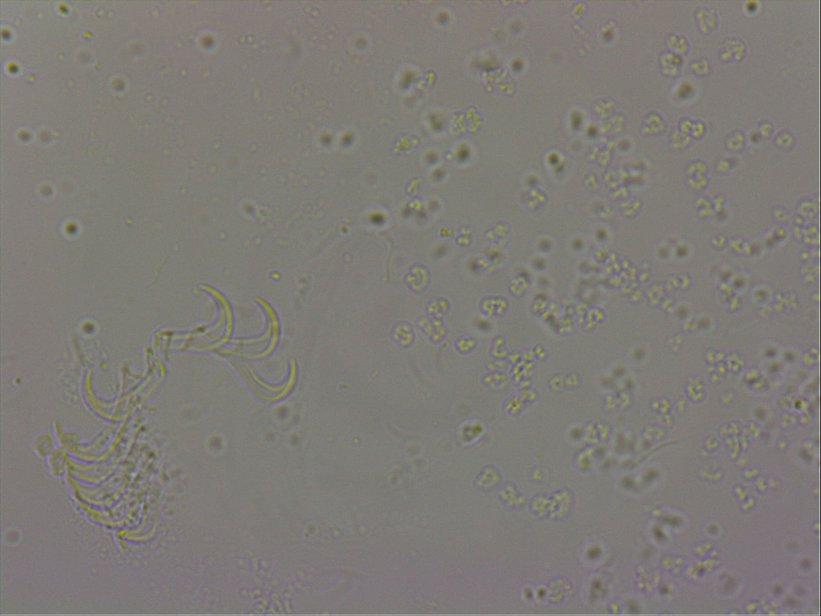 Echiniscoididae image