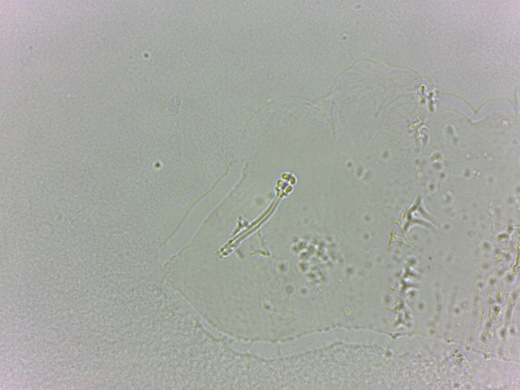 Calohypsibiidae image