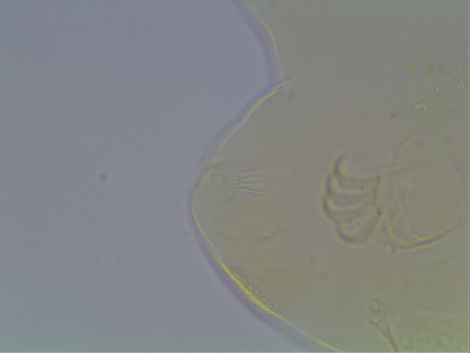 Echiniscus baius image