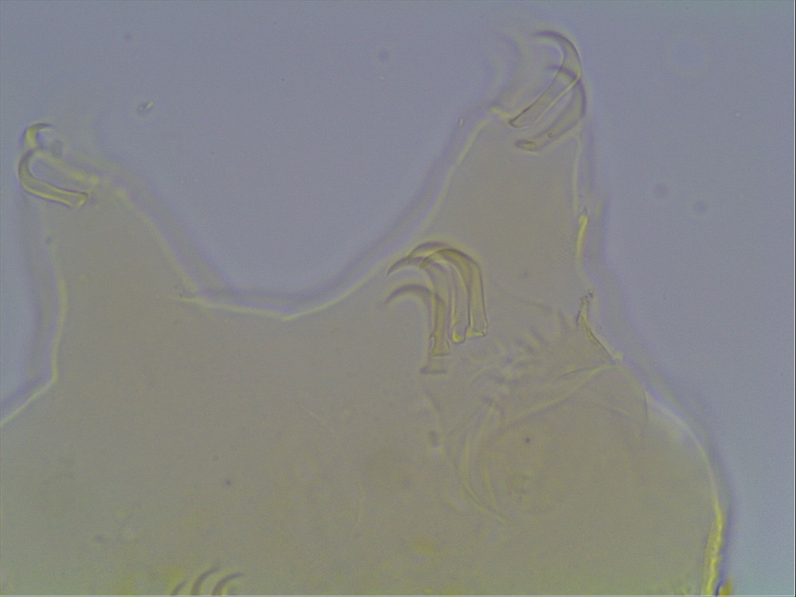 Echiniscus baius image