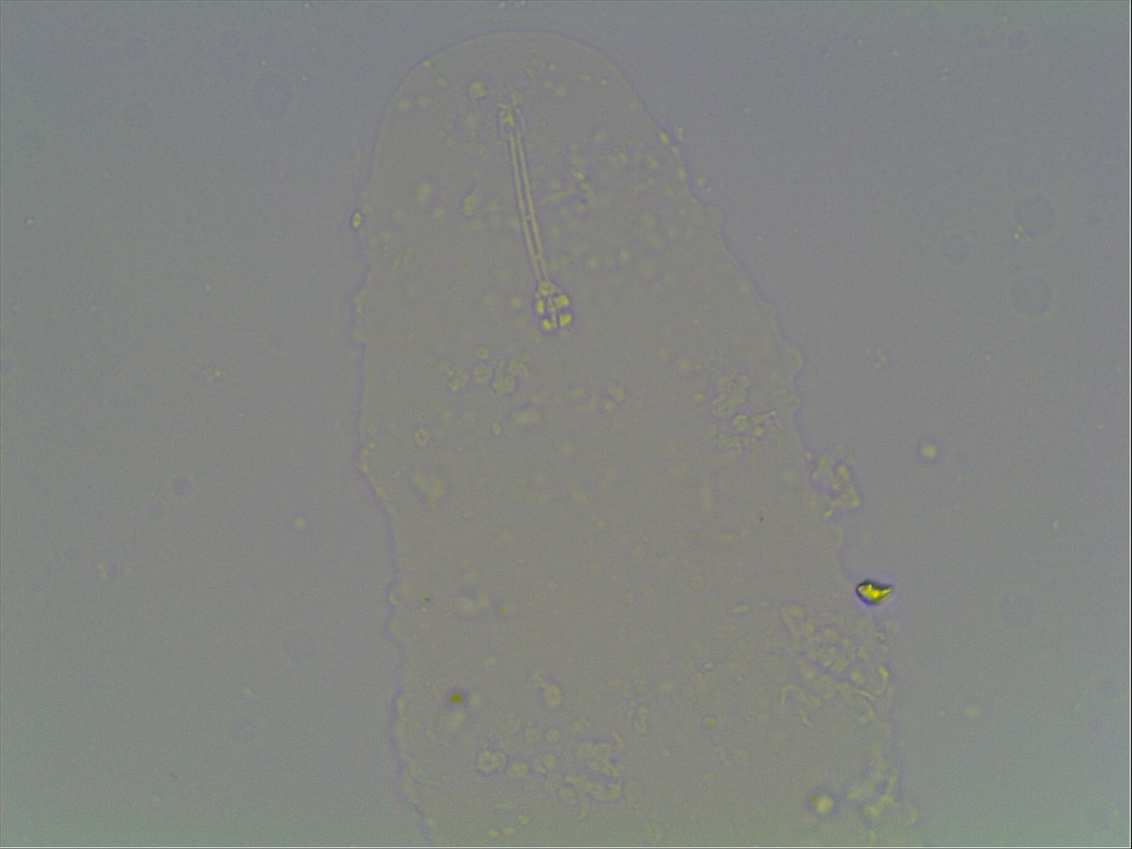 Ramazzottius baumanni image