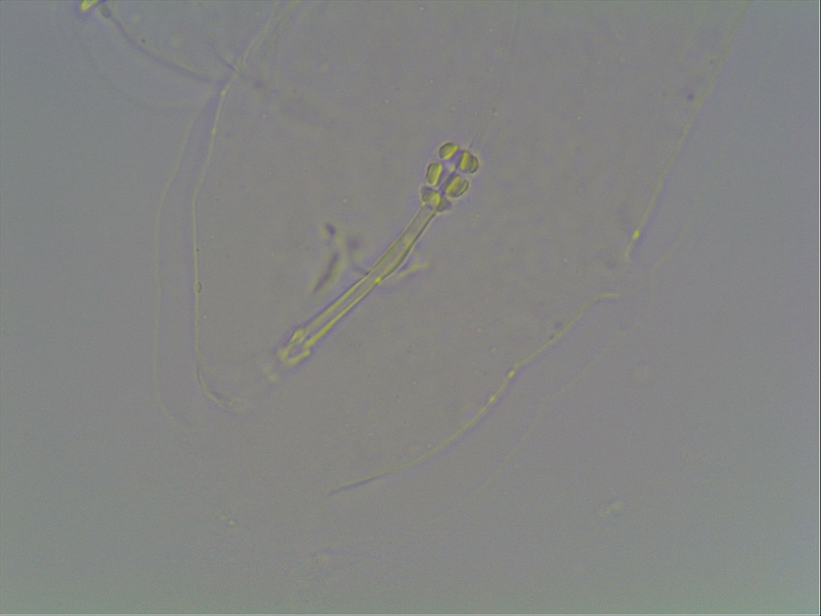 Hypsibius calcaratus image