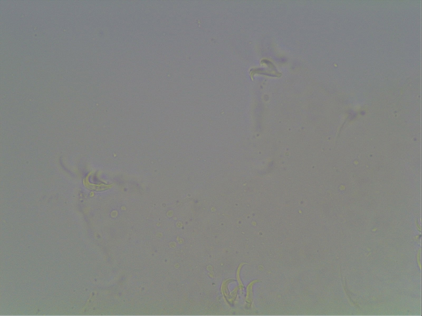 Hypsibius calcaratus image