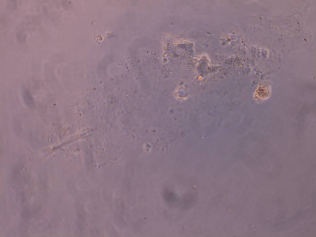 Schusterius tridigitus image