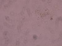 Schusterius tridigitus image