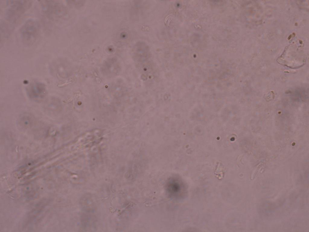 Schusterius tridigitus image