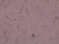 Schusterius tridigitus image