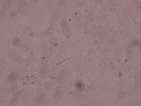 Schusterius tridigitus image