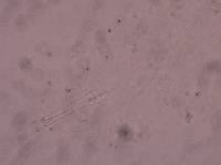 Schusterius tridigitus image