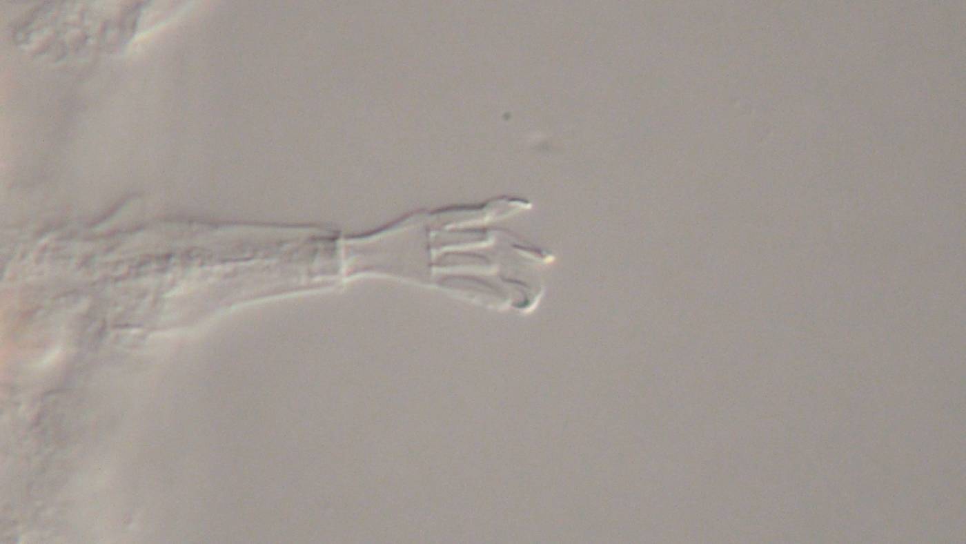Mutaparadoxipus duodigifinis image