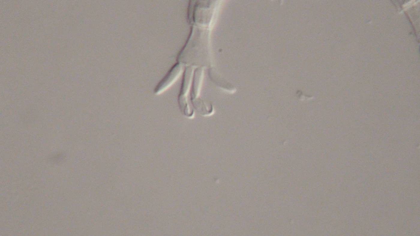 Mutaparadoxipus duodigifinis image