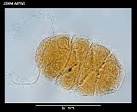 Echiniscus jenningsi image