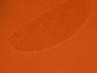 Doryphoribius zyxiglobus image
