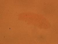 Doryphoribius zappalai image