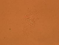 Echiniscoides sigismundi image