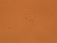 Echiniscoides sigismundi image